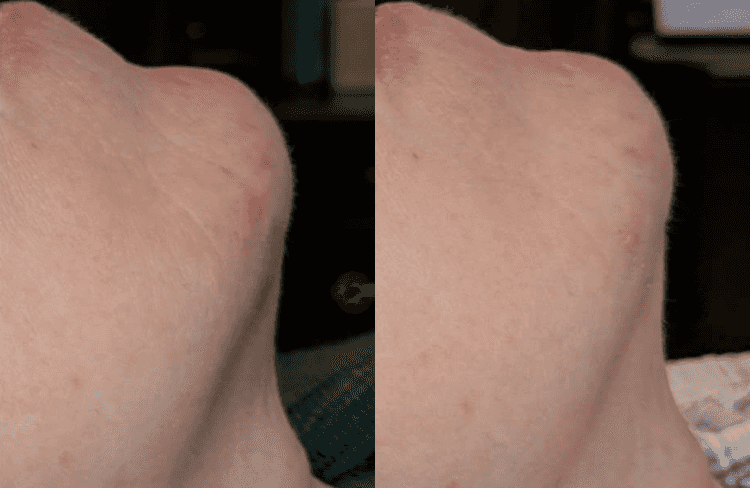 Before and after of Michele Corley client using home care products for aging.